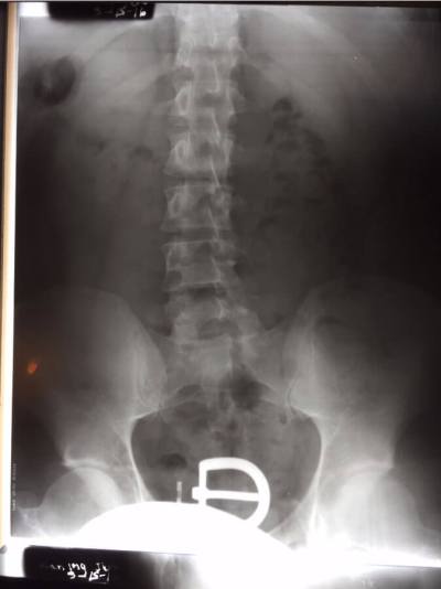 back x-ray